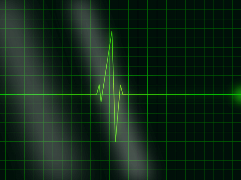 electrocardiogramme-pédicurie-podologie Mesure de pulsation en pédicurie podologie